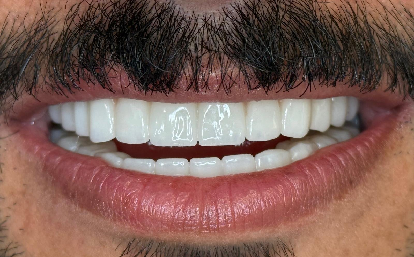 Sonrası