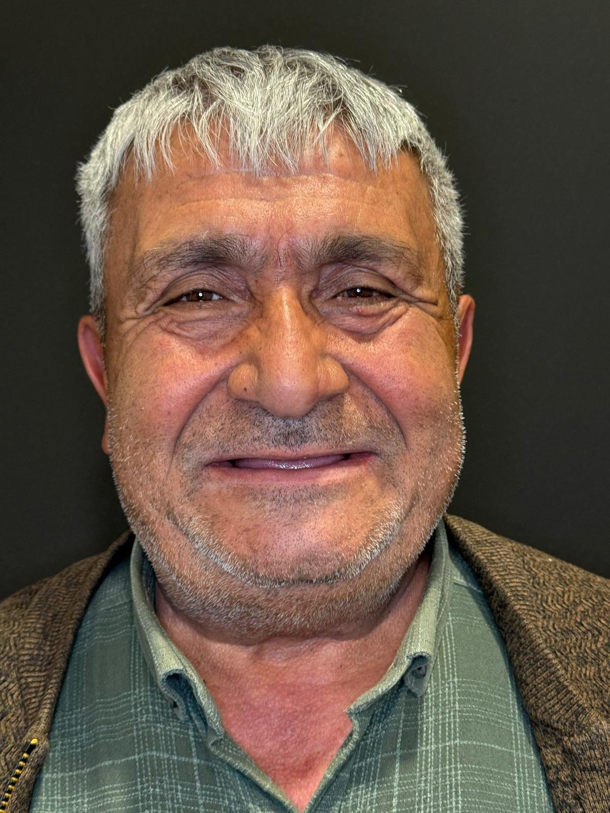 Öncesi